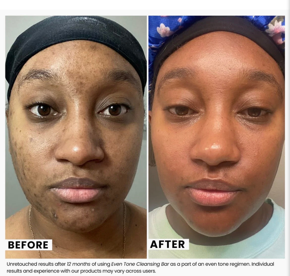 Even Tone Cleansing Bar