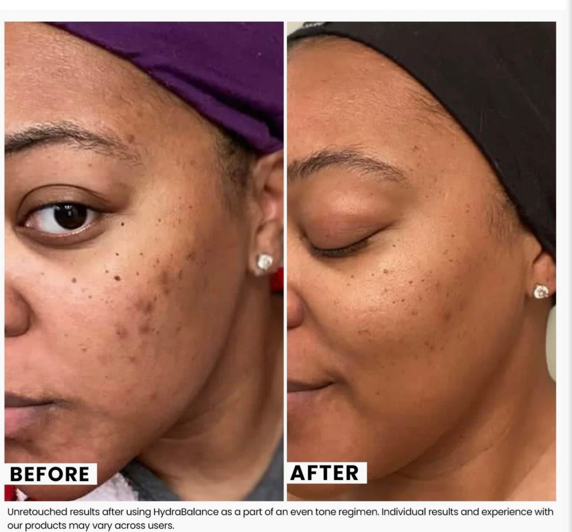 HydraBalance Brightening
Moisture Infusion