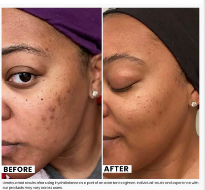 HydraBalance Brightening
Moisture Infusion