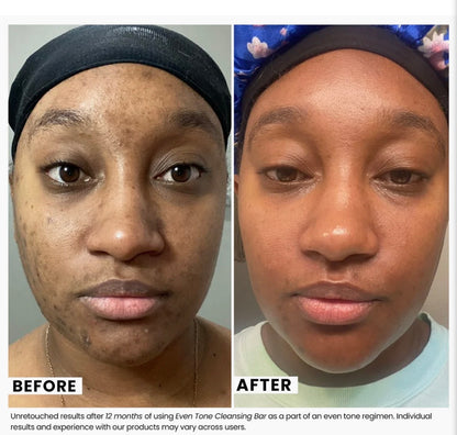 Even Tone Cleansing Bar