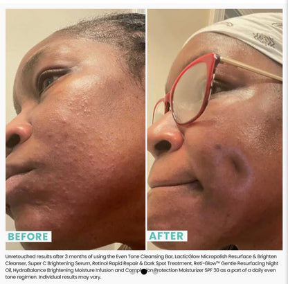 Mini LacticGlow Micropolish
Cleanser