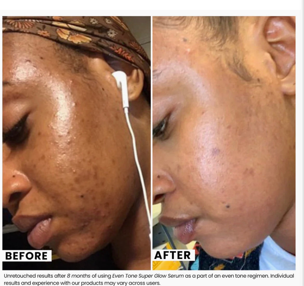 Even Tone Super Glow Serum